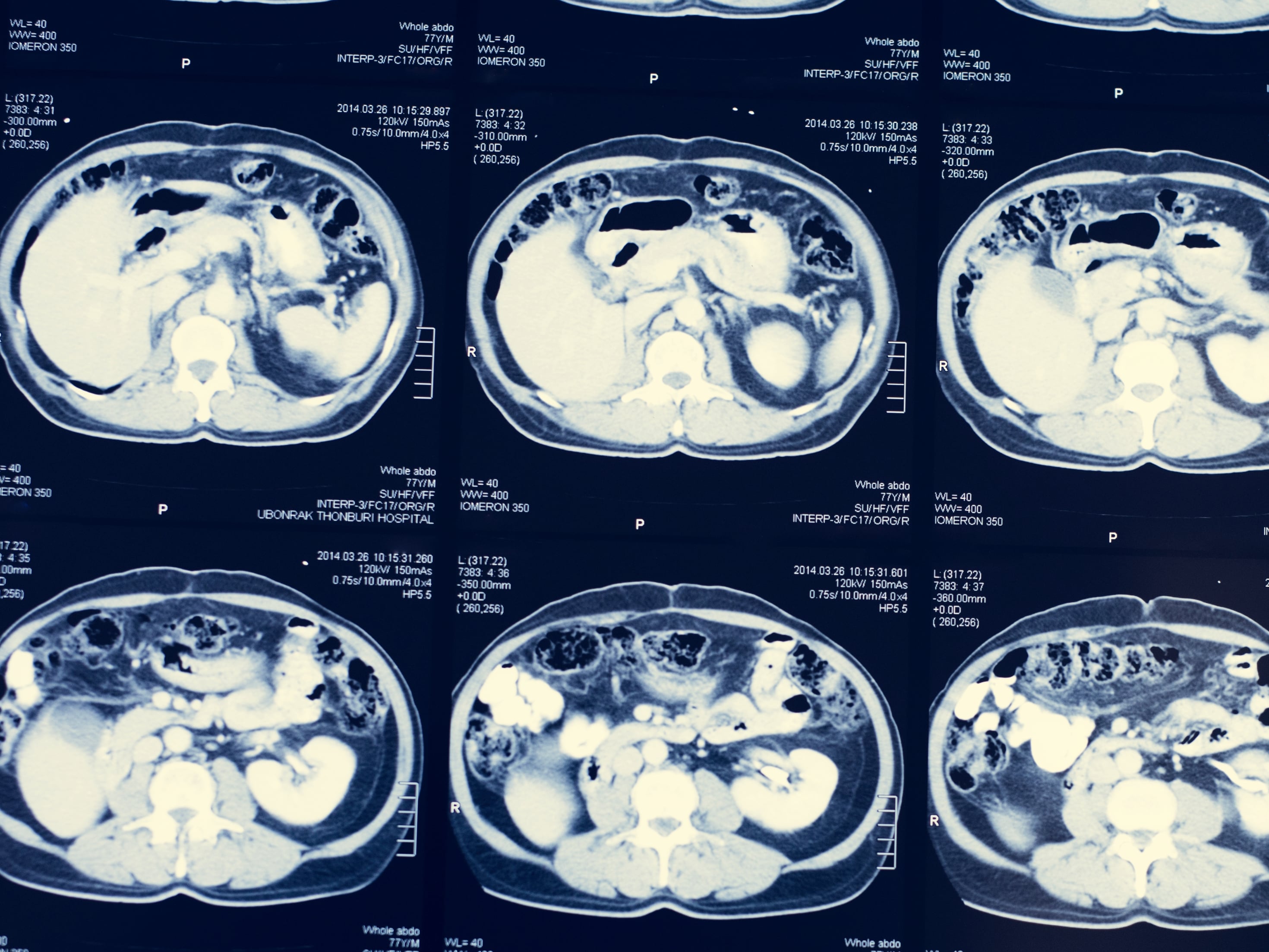 multi-panel brain scan imaging