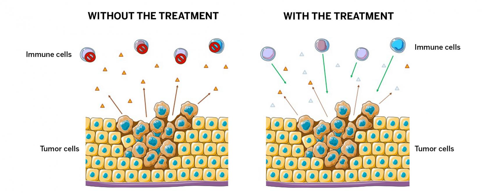 diagram of George Georgiou's cancer treatment research